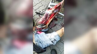 Shit, The Victim's Leg Was Broken.