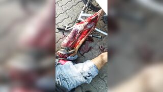 Shit, The Victim's Leg Was Broken.