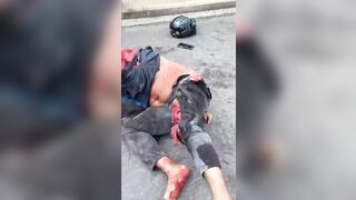 Malaysian Motorcyclist Suffers Serious Accident