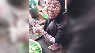 What Disease Is This?