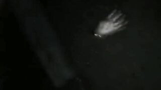 A Dying Woman With Her Skull Chopped Off 