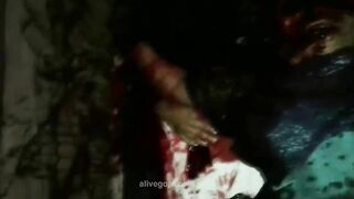 A Dying Woman With Her Skull Chopped Off 