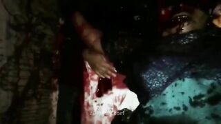 A Dying Woman With Her Skull Chopped Off 
