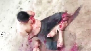 Man Dies After Arms And Legs Chopped Off 