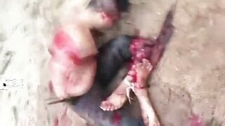 Man Dies After Arms And Legs Chopped Off 