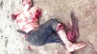 Man Dies After Arms And Legs Chopped Off 