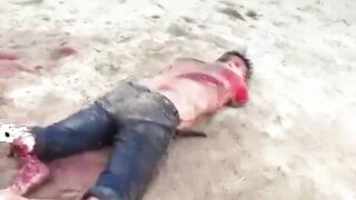Man Dies After Arms And Legs Chopped Off 