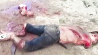 Man Dies After Arms And Legs Chopped Off 