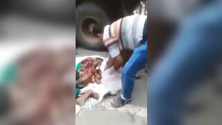 A Man Under The Wheels Of A Truck Turned Into A Piece Of Meat