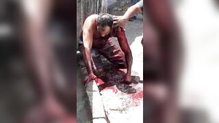 A Man Was Stabbed Multiple Times In The Back 