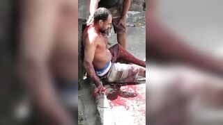A Man Was Stabbed Multiple Times In The Back 
