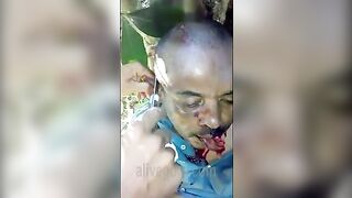 Man's Ears Cut Off, He Forced To Eat Them 