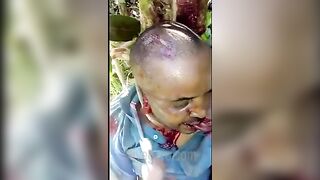 Man's Ears Cut Off, He Forced To Eat Them 