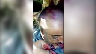 Man's Ears Cut Off, He Forced To Eat Them 