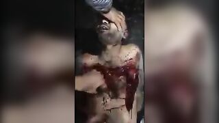 A Man Groans In Pain As He Is Skinned 