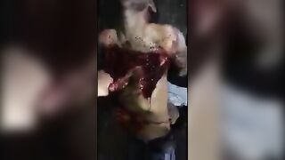 A Man Groans In Pain As He Is Skinned 