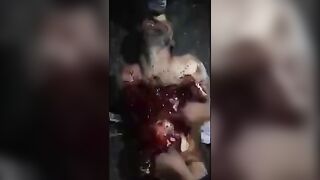 A Man Groans In Pain As He Is Skinned 