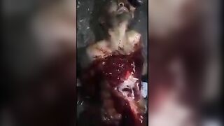 A Man Groans In Pain As He Is Skinned 