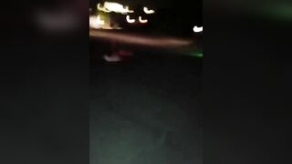 As A Result Of The Accident, The Man Lost A Leg And An Arm.
