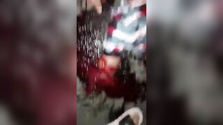 As A Result Of The Accident, The Man Lost A Leg And An Arm.