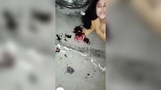 As A Result Of The Accident, The Man Lost A Leg And An Arm.
