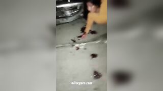 As A Result Of The Accident, The Man Lost A Leg And An Arm.