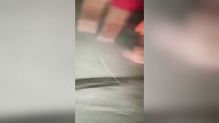 As A Result Of The Accident, The Man Lost A Leg And An Arm.