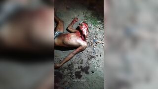 Brazilian Man Nearly Beheaded By Gang 