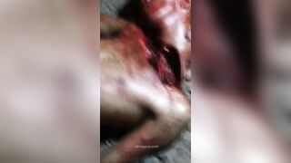 Brazilian Man Nearly Beheaded By Gang 