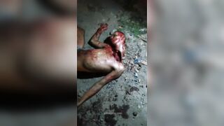 Brazilian Man Nearly Beheaded By Gang 