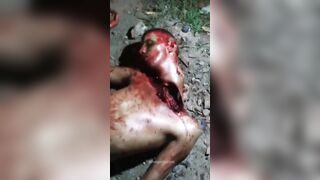 Brazilian Man Nearly Beheaded By Gang 