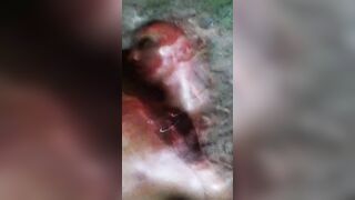 Brazilian Man Nearly Beheaded By Gang 