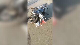 Dead Motorcyclist And His Broken Leg 