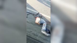 Dead Motorcyclist And His Broken Leg 