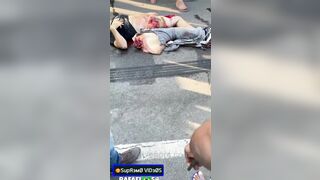 Dead Motorcyclist And His Broken Leg 