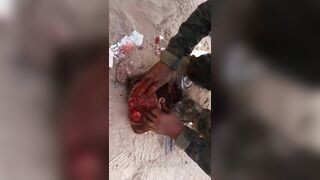Decapitation And Eye Cutting 