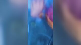 Drunk Driver Causes Accident And Skull Fracture 