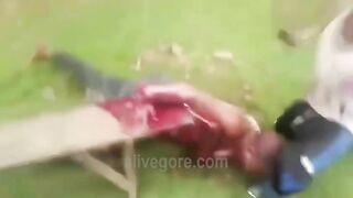 Guy Gets His Arm Chopped Off With A Machete 