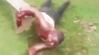 Guy Gets His Arm Chopped Off With A Machete 