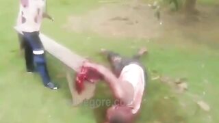 Guy Gets His Arm Chopped Off With A Machete 