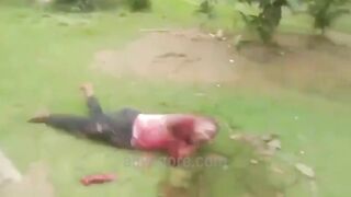 Guy Gets His Arm Chopped Off With A Machete 