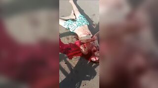 Guy Was Stabbed In The Throat And Bled To Death On The Street.