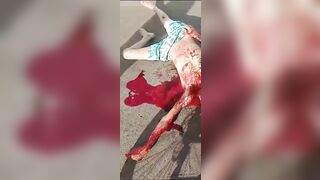 Guy Was Stabbed In The Throat And Bled To Death On The Street.