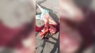 Guy Was Stabbed In The Throat And Bled To Death On The Street.