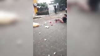 It's All Fun And Games Until You Lose A Leg In A Fireworks Display