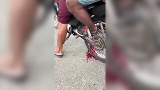 KrudPlug Mobile - Motorcycle Passenger's Foot Is Stuck