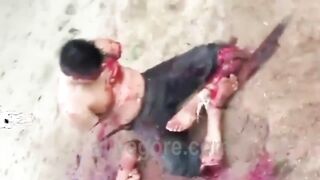 Man's Arms And Legs Chopped Off While Still Alive 