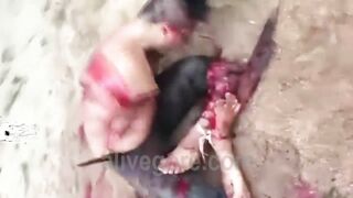 Man's Arms And Legs Chopped Off While Still Alive 