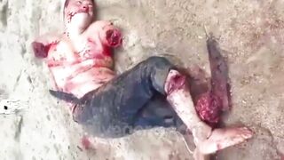 Man's Arms And Legs Chopped Off While Still Alive 