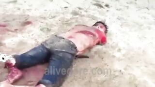Man's Arms And Legs Chopped Off While Still Alive 